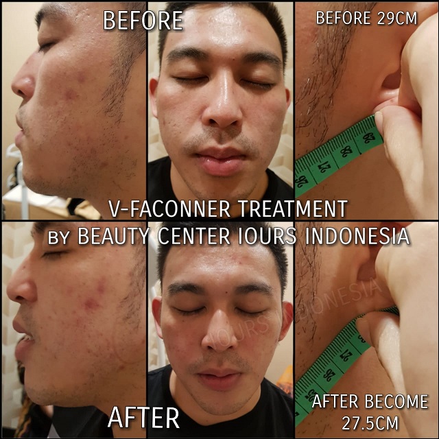 Beauty Treatment